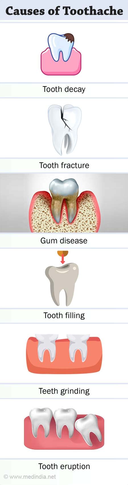 Toothache Symptoms, Causes, And Treatments Dental Depot, 46% OFF