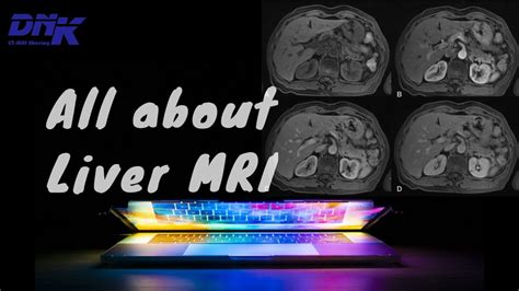 Liver Mri - Cách chụp mri bụng cơ bản - YouTube