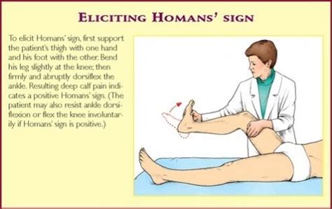 A fun and easy way to remember 'Homan's sign' in Medicine & Healthcare ...