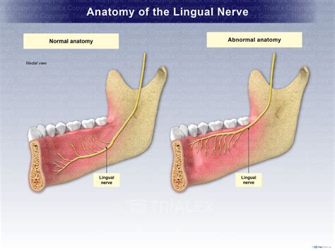 Anatomy of the Lingual Nerve - TrialQuest Inc.