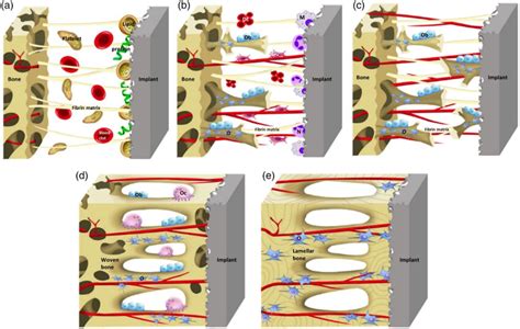 Schematic of the osseointegration process starts with (a) the blood... | Download Scientific Diagram