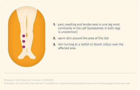 Dvt Warning Signs