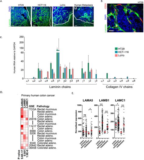 Laminin 511 is expressed by colon cancer cells in metastatic tumours... | Download Scientific ...