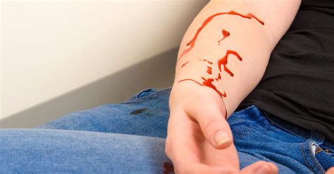 Bleeding to Death: Am I at Risk, and How Can I Stop It?