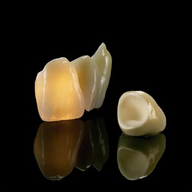 Bruxzir Crowns - Zirconia Crowns- Cercon Zirconium Crowns at Barth ...