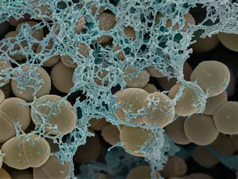 Streptococci gordonii biofilm grown on a dental restorative; imaged by scanning electron ...