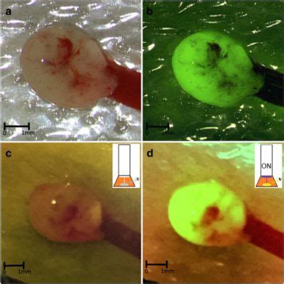 The Fluoropen: a simple low-cost device to detect intraoperative fluorescein fluorescence in ...