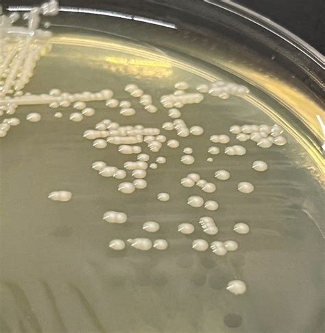 Pluralibacter gergoviae | Microchem Laboratory