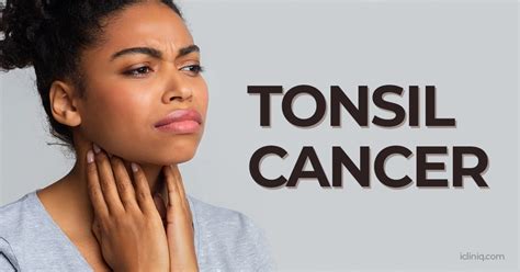 Tonsil Cancer | Causes | Symptoms | Diagnosis | Treatment