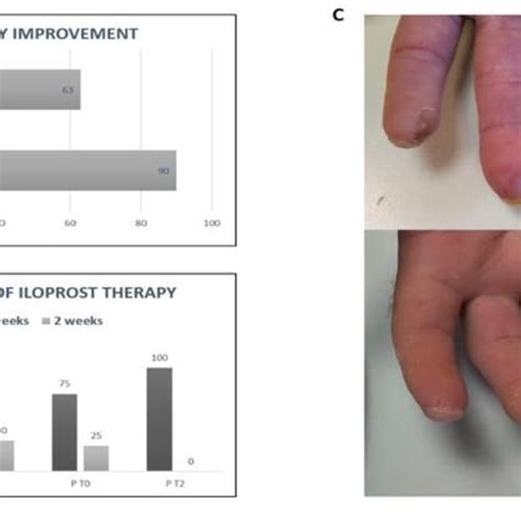 (A) Percentage of group 1 patients with skin texture improvement after ...