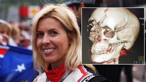 How woman survived brutal Formula One crash