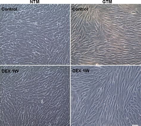 The morphology of trabecular meshwork cells before and after... | Download Scientific Diagram