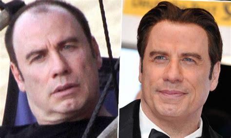 John Travolta leaves hairpiece at home and embraces baldness on holiday ...