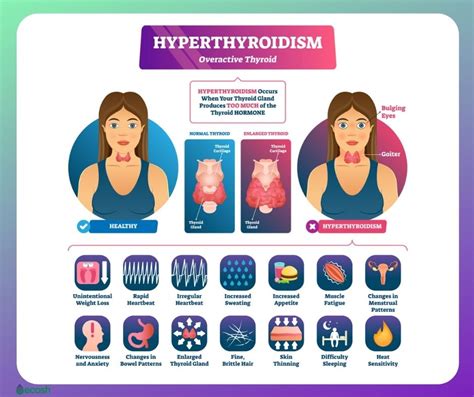 THYROID DISEASE - Symptoms, Causes, Risk Groups and Treatment - Ecosh