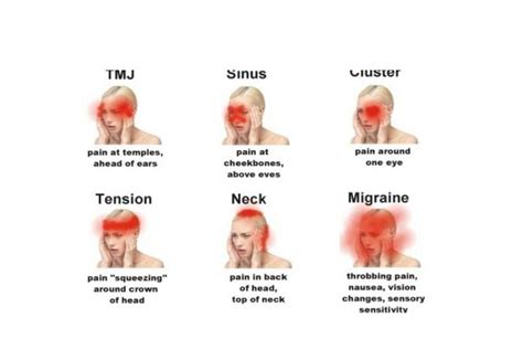 HeadAches | Headache types, Neck headache, Head pain