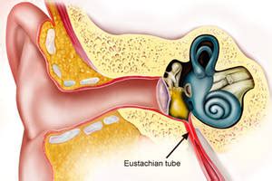 Symptoms of Eustachian Tube Dysfunction - IYTmed.com