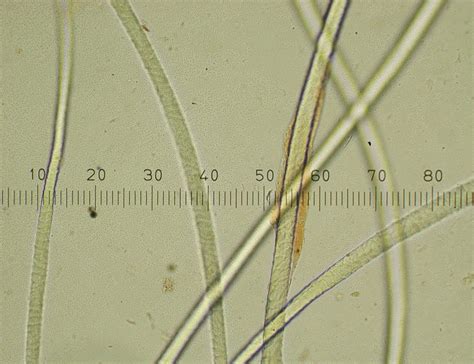 Fiber Microscopy 3