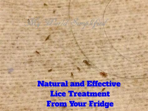 safe and natural lice treatment