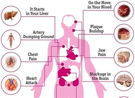 What High Cholesterol Does to Your Body - Dr. Sam Robbins