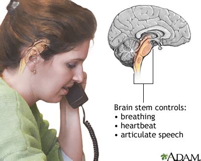 Stroke: MedlinePlus Medical Encyclopedia