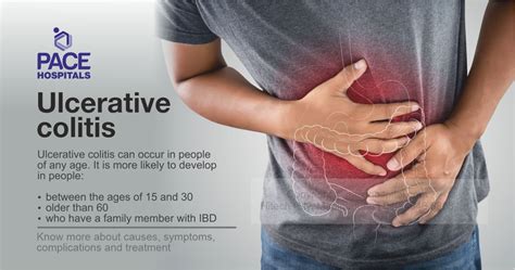 Ulcerative colitis: causes, symptoms, complications and treatment