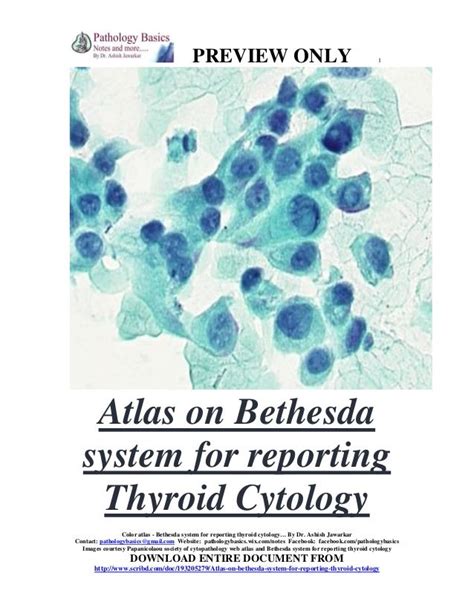 color atlas on bethesda system for reporting thyroid cytology