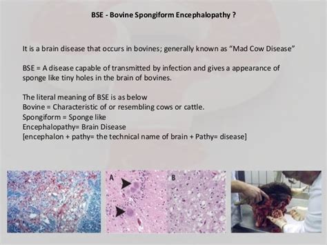 Spongiform Encephalopathy's