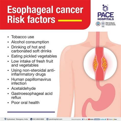 Esophagus Cancer