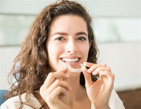 Fast Invisalign Treatment | Invisalign Lite Winchester | GG Orthodontics