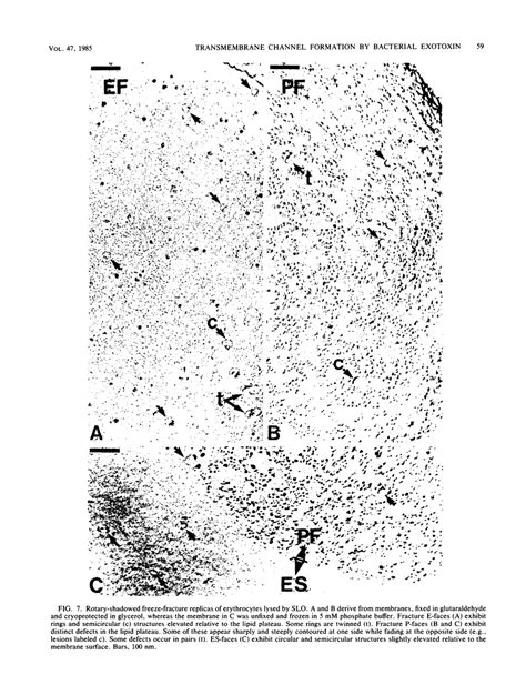 Mechanism of membrane damage by streptolysin-O - PMC