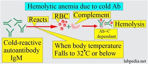 Anemia:- Part 8 - Hemolytic Anemias Classification, Autoimmune ...