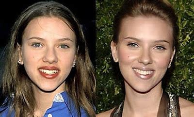 trendystyle: Celebrities Jessica Simpson Before & After Plastic Surgery