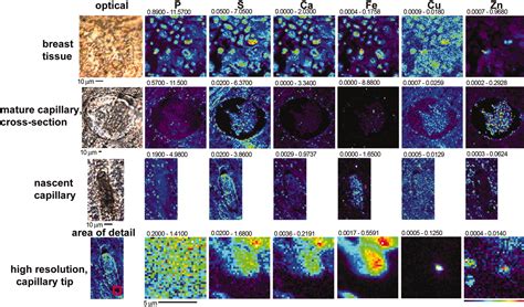 X-ray fluorescence microscopy reveals large-scale relocalization and extracellular translocation ...