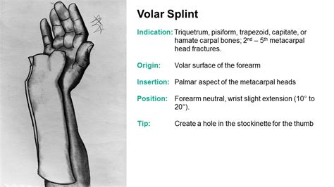 Volar Hand Splint