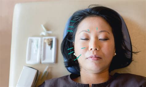 Accredited Acupuncture School | Pacific College