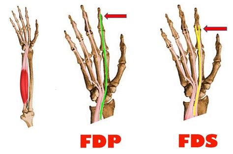 Common Finger Injuries from Rock Climbing – Dr. James Lee PT, DPT, FAAOMPT – Medium