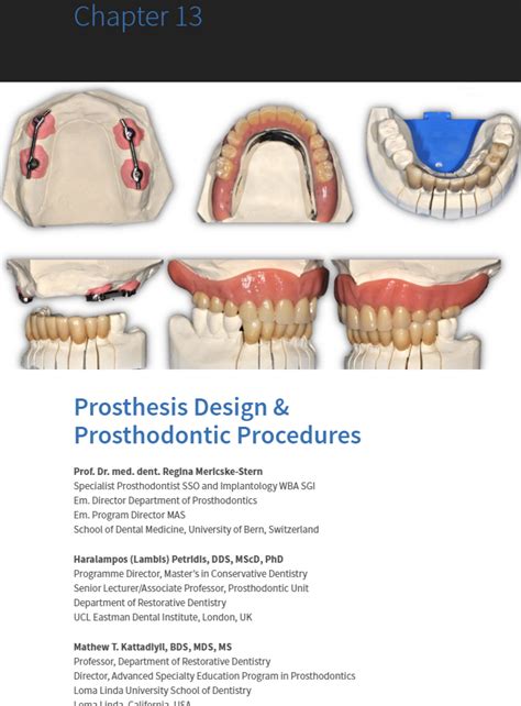 (PDF) Prosthesis design & prosthodontic procedures