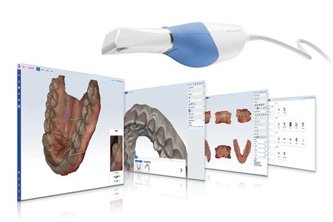 Planmeca Romexis® CAD/CAM module takes digital impressions to the next ...