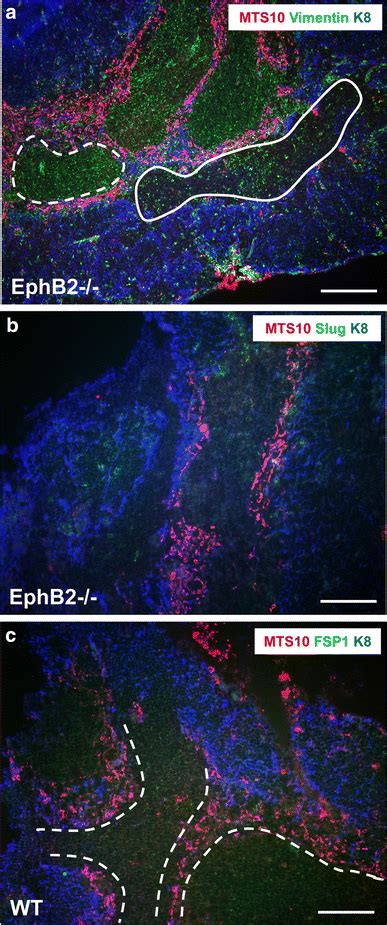 Epithelial–mesenchyme transition markers are not expressed in mEFAs. a ...