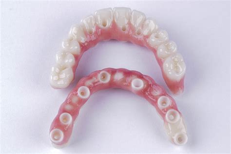 Could My Smile Be Restored With Zirconia Dental Implants In New York ...