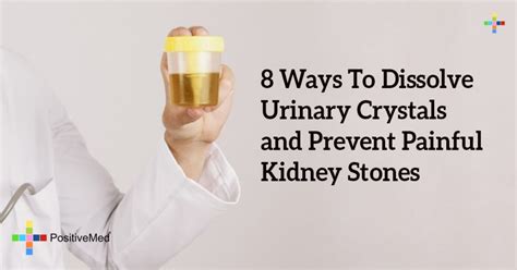 8 Ways To Dissolve Urinary Crystals and Prevent Painful Kidney Stones