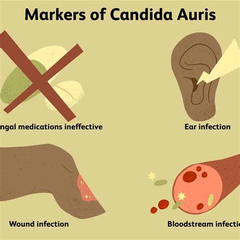 C auris skin symptoms