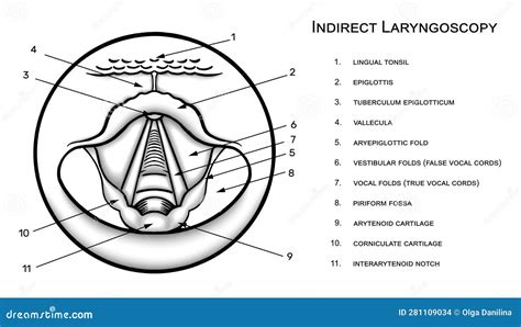 Laryngoscopy Cartoons, Illustrations & Vector Stock Images - 32 ...