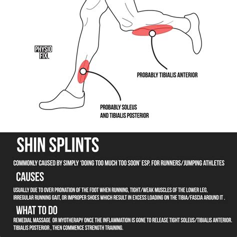 Shin Splints Cure