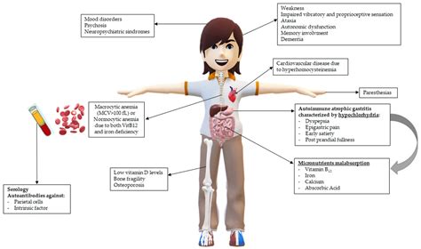 How To Diagnose Pernicious Anemia - Riseband2