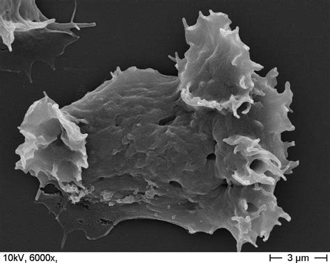 Dictyostelium discoideum - an amoeba/slime mold. I was able to picture ...