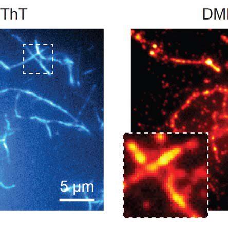 α-Syn amyloid fibrils association with lipid observed by TIRFM imaging.... | Download Scientific ...