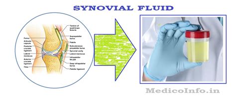 Synovial Fluid Collection & Analysis : Significance, Collection, Patient preparation ...