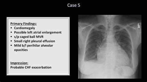 How to Interpret a Chest X-Ray (Lesson 10 - Self Assessment): Part 1 - YouTube