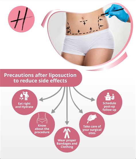 Liposuction Side Effects: Is Liposuction Safe, Risk of Liposuction